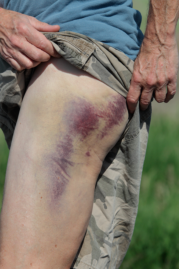 artie-bruise-close-by-rick-newman-_e0e8701